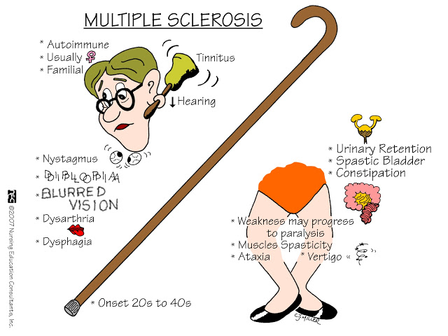Multiple+Sclerosis